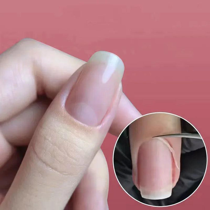 One picture shows a close-up of the scissors cutting dry skin and in the larger picture you see a human hand with the nail area free of dry skin. Shown on a red background.