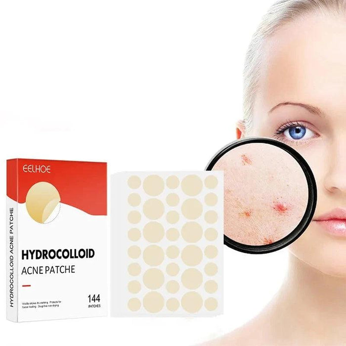 A close-up of a woman's face with a magnifying glass highlighting acne spots next to the acne patch product.